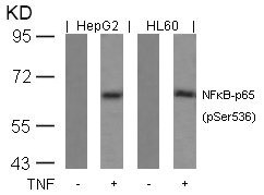 Anti-Phospho-RELA (Ser536)