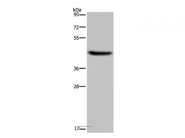 Anti-HSD3B1