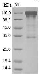 Mast/stem cell growth factor receptor Kit (KIT), partial, human, recombinant