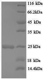 GTPase HRas (Hras), rat, recombinant