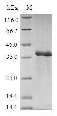 40S ribosomal protein S27 (RPS27), human, recombinant