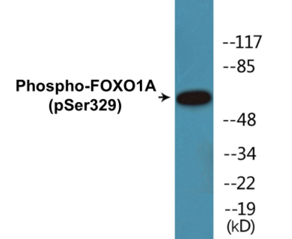 FOXO1A (Phospho-Ser329) Colorimetric Cell-Based ELISA Kit