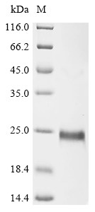 CD27 antigen (Cd27), partial, Mesocricetus auratus, recombinant