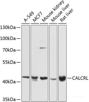 Anti-CALCRL