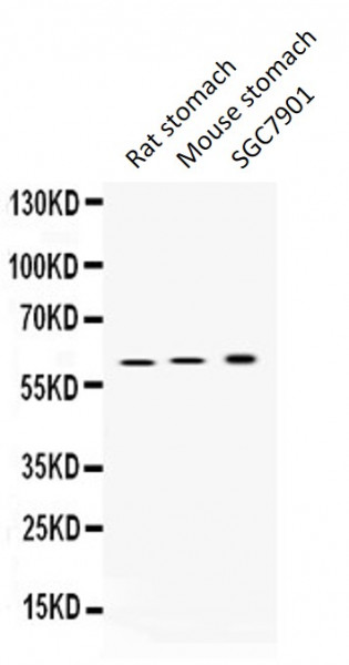 Anti-ATP4B