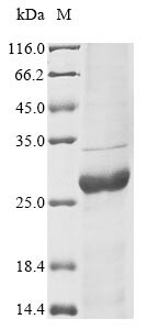 Trifunctional purine biosynthetic protein adenosine-3 (GART), partial, human, recombinant