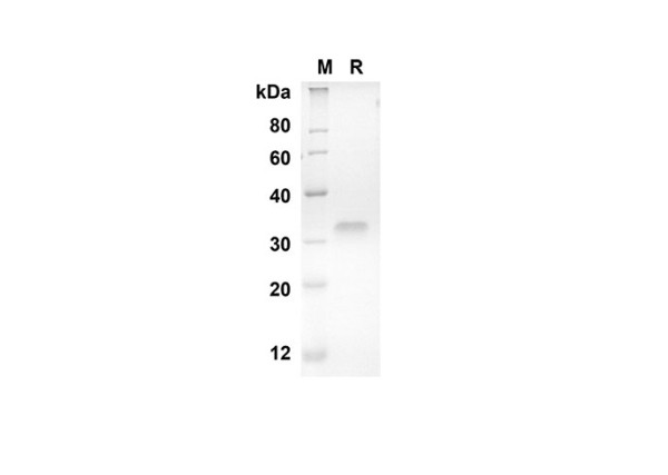 CD40 Protein (His Tag) (recombinant human)