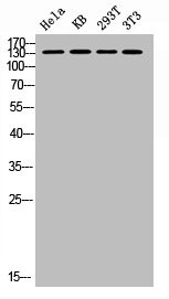 Anti-Phospho-PTK2 (S843)