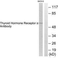 Anti-THRA