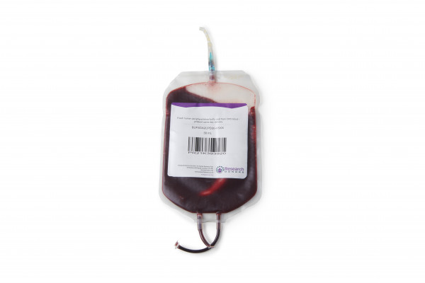 Fresh human peripheral blood buffy coat from lithium heparin blood - chilled overnight delivery