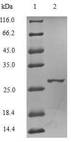 Catechol O-methyltransferase (COMT), partial, human, recombinant