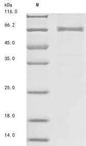 5&#039;-AMP-activated protein kinase catalytic subunit alpha-1 (Prkaa1), mouse, recombinant