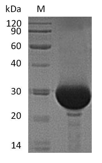 Carbonic anhydrase 1 (CA1) (Active), human, recombinant