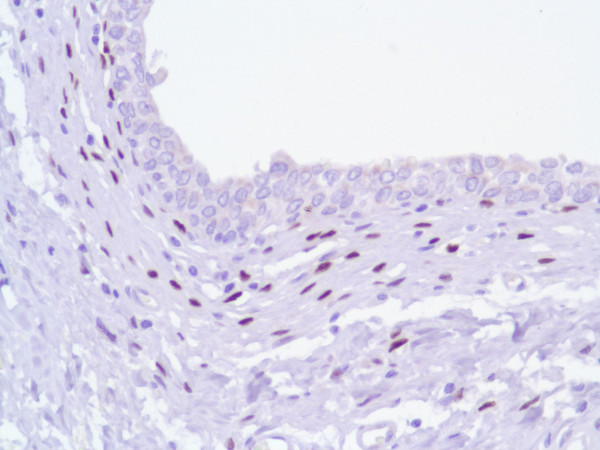 Anti-Progesterone Receptor (PR), clone SP42