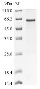 Squalene monooxygenase (SQLE), partial, human, recombinant