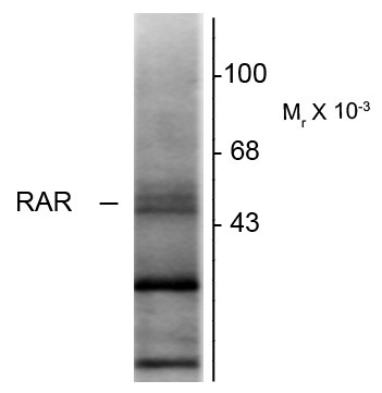Anti-Retinoic Acid Receptor beta, clone 336