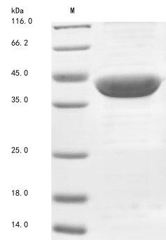 Acetyl-CoA acetyltransferase, mitochondrial (ACAT1), human, recombinant