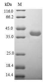 Neuronal acetylcholine receptor subunit alpha-3 (CHRNA3), partial, human, recombinant