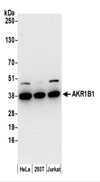 Anti-AKR1B1