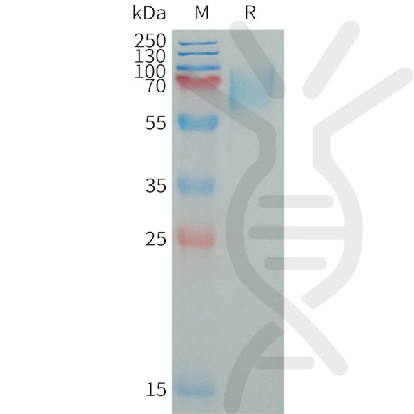 Human LILRA2 Protein, His Tag