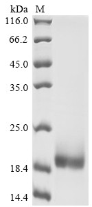 T-cell surface glycoprotein CD3 epsilon chain (Cd3e), partial, mouse, recombinant