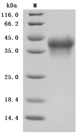 Interleukin-2 receptor subunit alpha (IL2RA), partial (Active), human, recombinant