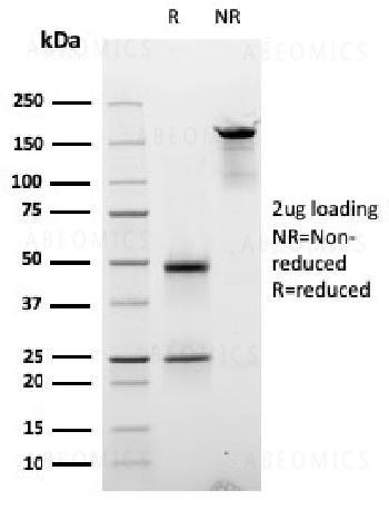 Anti-Cyclin D2 Monoclonal Antibody (Clone: CCND2/2620)