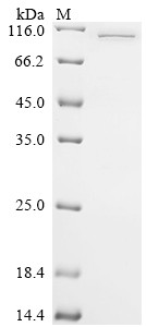 DNA polymerase theta (POLQ), partial, human, recombinant