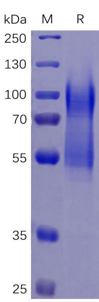 Human CD34 Protein, His Tag