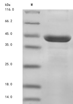 Ectonucleoside triphosphate diphosphohydrolase 1 (Entpd1), partial, rat, recombinant