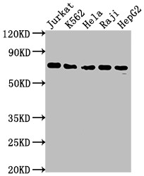 Anti-FUBP1 Recombinant Monoclonal, clone 7C3