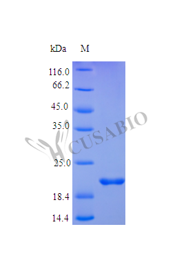 Tumor necrosis factor receptor superfamily member 1A protein (TNFRSF1A), partial (Active), human, re