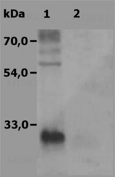 Anti-NTAL / LAB Polyclonal Antibody