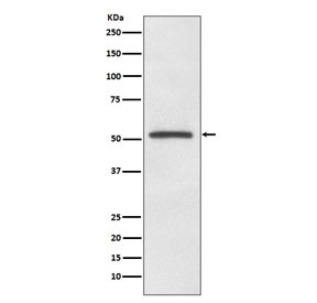 Anti-MITF, clone AOED-13