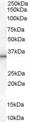 Anti-UCP1, C-terminal