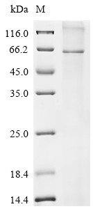 Glucagon-like peptide 2 receptor (GLP2R), human, recombinant