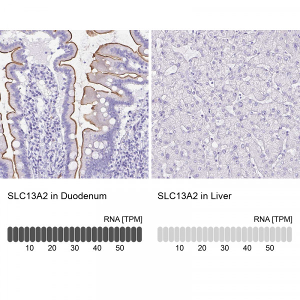 Anti-SLC13A2