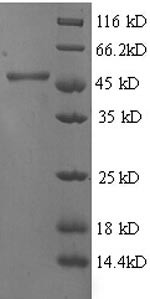 4-Hydroxyphenylpyruvate dioxygenase (HPD), human, recombinant