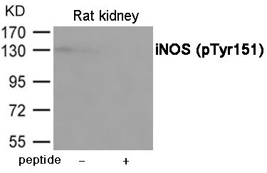 Anti-Phospho-NOS2 (Tyr151)
