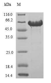 Carbonic anhydrase 9 (CA9), partial, human, recombinant