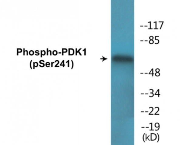 PDK1 (Phospho-Ser241) Colorimetric Cell-Based ELISA Kit