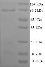 Atrial natriuretic peptide receptor 1 (NPR1), partial, human, recombinant