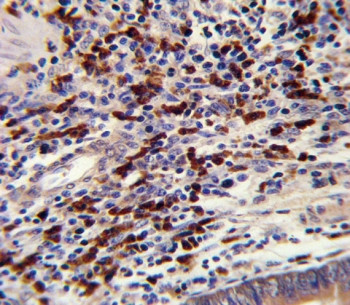 Anti-CNOT8 / CCR4-NOT transcription complex subunit 8