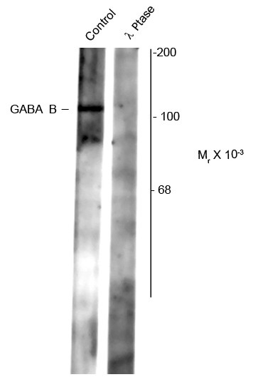 Anti-phospho-GABAB Receptor 2 (Ser783)