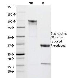 Anti-HLA-DR (MHC II), clone IPO-10