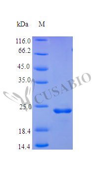 Fibroblast growth factor 9 protein (FGF9), partial (Active), human, recombinant