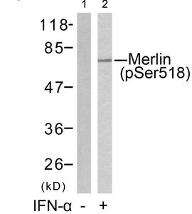 Anti-Phospho-NF2 (Ser518)