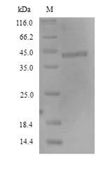 Fc receptor-like protein 4 (FCRL4), partial, human, recombinant