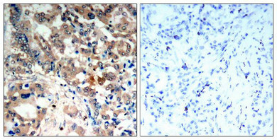 Anti-Phospho-PRKAA1/PRKAA2 (Thr183/Thr172)