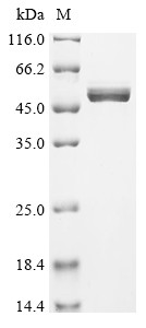 Calreticulin (CALR), human, recombinant